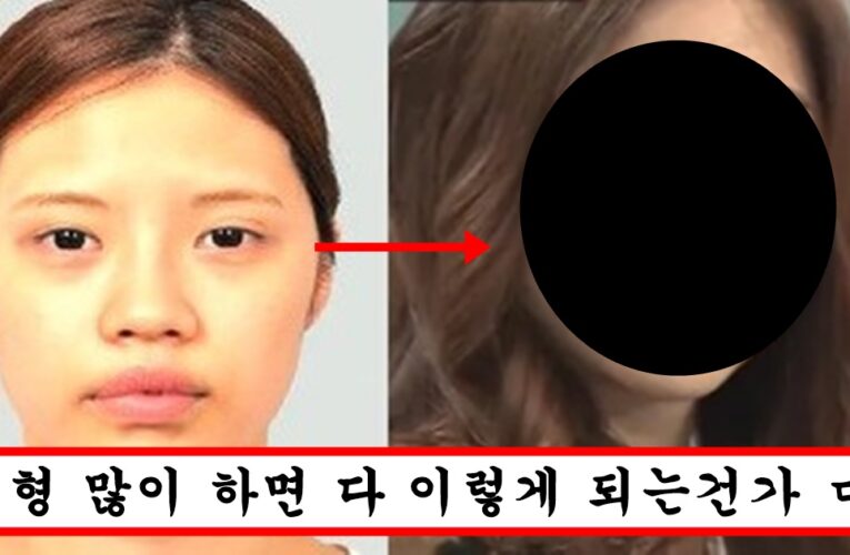 예뻐지고 싶어서 성형수술 30번 해버린 한국인 여성의 최후